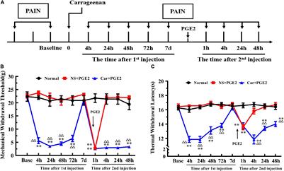 Electroacupuncture Regulates Pain Transition Through Inhibiting PKCε and TRPV1 Expression in Dorsal Root Ganglion